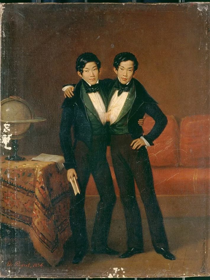Chang Eng, captured in this 1836 portrait. (Supplied: Wellcome Collection)