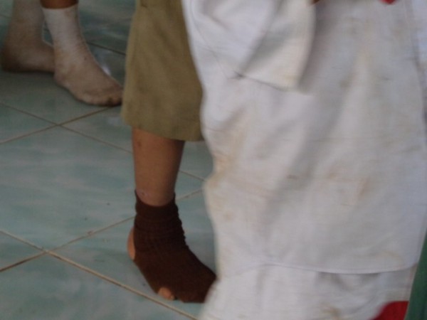 The sock problem was not as prevalent today, but a lot were simply not wearing socks.