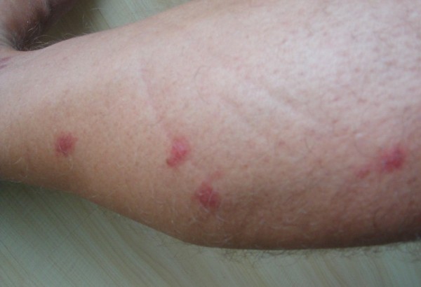 Red mark 2 (800x546).jpg